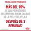 85 g Royal Canin Intense Beauty Saquetas em Gelatina para gatos, , large Indicador imagem número 4